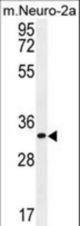 ZC3H8 Antibody western blot of mouse Neuro-2a cell line lysates (35 ug/lane). The ZC3H8 antibody detected the ZC3H8 protein (arrow).