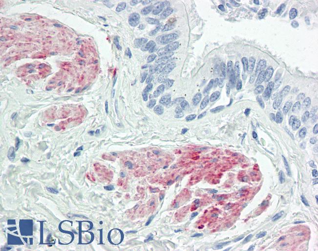 Anti-ZC3H8 antibody IHC of human lung, smooth muscle. Immunohistochemistry of formalin-fixed, paraffin-embedded tissue after heat-induced antigen retrieval. Antibody LS-B8598 dilution 5 ug/ml.