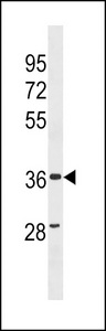 ZC3HAV1L Antibody western blot of human Uterus tissue lysates (35 ug/lane). The ZC3HAV1L antibody detected the ZC3HAV1L protein (arrow).