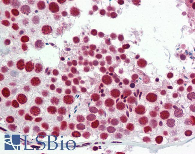 Anti-ZC3HC1 / NIPA antibody IHC staining of human testis. Immunohistochemistry of formalin-fixed, paraffin-embedded tissue after heat-induced antigen retrieval. Antibody LS-B9866 concentration 20 ug/ml.