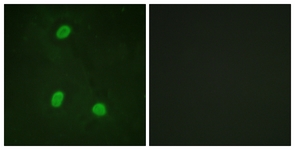 Immunofluorescence of HeLa cells, using NIPA Antibody. The picture on the right is treated with the synthesized peptide.