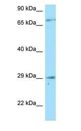 TNFRSF13B / TACI antibody Western Blot of THP-1.