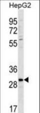 ZDHC3 Antibody western blot of HepG2 cell line lysates (35 ug/lane). The ZDHC3 antibody detected the ZDHC3 protein (arrow).
