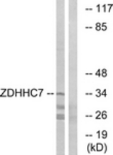 Western blot of extracts from HUVEC cells, using ZDHHC7 Antibody. The lane on the right is treated with the synthesized peptide.