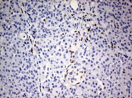 IHC of paraffin-embedded Human pancreas tissue using anti-ZEB1 mouse monoclonal antibody. (Heat-induced epitope retrieval by 10mM citric buffer, pH6.0, 120°C for 3min).