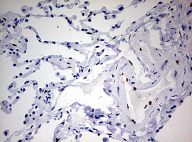 IHC of paraffin-embedded Human lung tissue using anti-ZEB1 mouse monoclonal antibody. (Heat-induced epitope retrieval by 10mM citric buffer, pH6.0, 120°C for 3min).