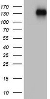 HEK293T cells were transfected with the pCMV6-ENTRY control (Left lane) or pCMV6-ENTRY ZEB1 (Right lane) cDNA for 48 hrs and lysed. Equivalent amounts of cell lysates (5 ug per lane) were separated by SDS-PAGE and immunoblotted with anti-ZEB1.