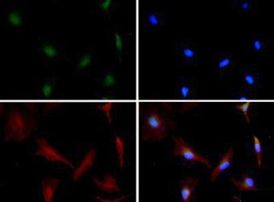 Immunocytochemistry: ZEB1 Antibody - ZEB1 antibody was tested in HeLa cells with Dylight 488 (green). Nuclei and alpha-tubulin were counterstained with DAPI (blue) and Dylight 550 (red).