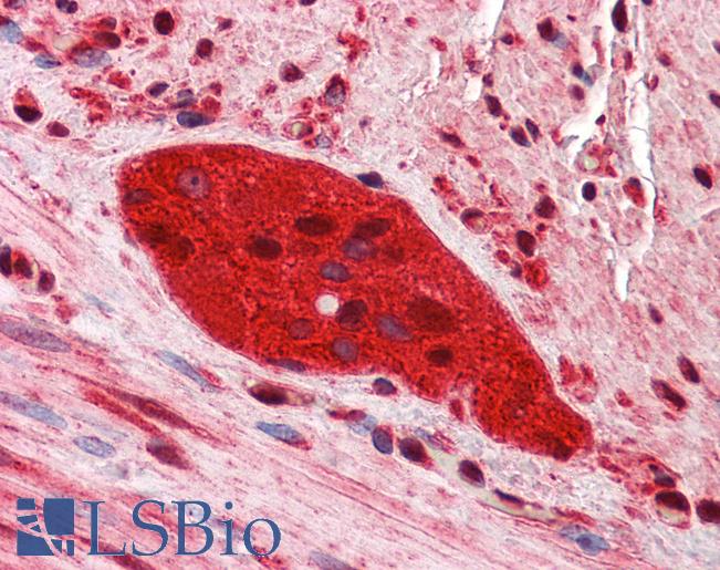 Anti-ZEB2 antibody IHC of human small intestine, myenteric plexus. Immunohistochemistry of formalin-fixed, paraffin-embedded tissue after heat-induced antigen retrieval. Antibody LS-B5644 concentration 2.5 ug/ml.