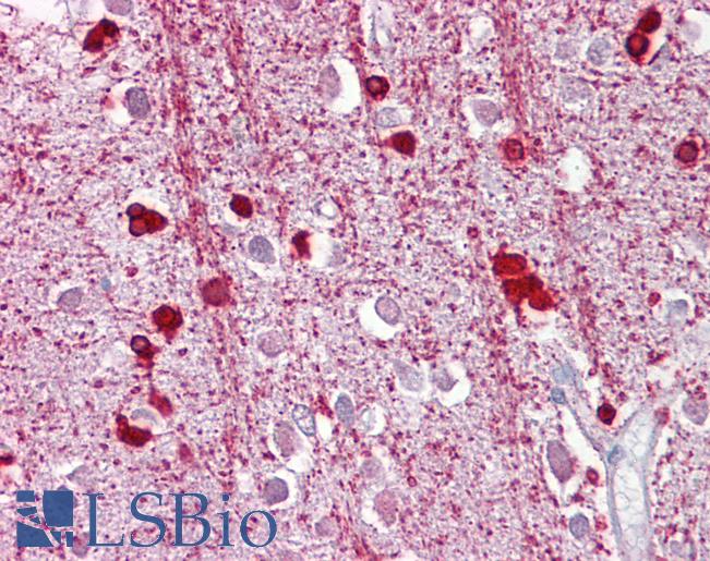Anti-ZEB2 antibody IHC of human brain, cortex. Immunohistochemistry of formalin-fixed, paraffin-embedded tissue after heat-induced antigen retrieval. Antibody LS-B6533 concentration 5 ug/ml.