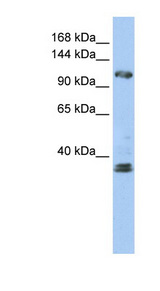 ZEB2 antibody LS-B6533 Western blot of Jurkat lysate.