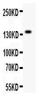 ZEB2antibody Western blot. All lanes: Anti ZEB2 at 0.5 ug/ml. WB: SMMC Whole Cell Lysate at 40 ug. Predicted band size: 136 kD. Observed band size: 136 kD.