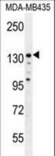 ZEB2 Antibody western blot of MDA-MB435 cell line lysates (35 ug/lane). The ZEB2 antibody detected the ZEB2 protein (arrow).