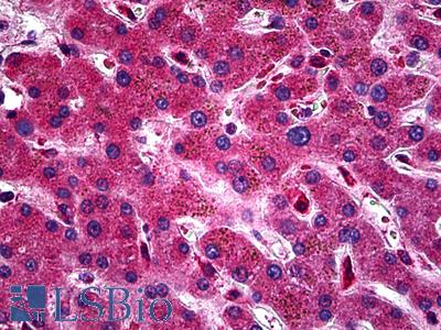 Anti-ZEB2 antibody IHC of human liver. Immunohistochemistry of formalin-fixed, paraffin-embedded tissue after heat-induced antigen retrieval. Antibody LS-B5497 concentration 5 ug/ml.