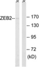 Western blot of extracts from Jurkat cells, using ZEB2 Antibody. The lane on the right is treated with the synthesized peptide.