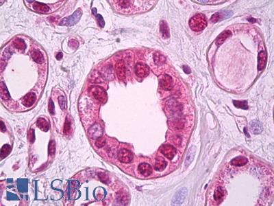Anti-ZEB2 antibody IHC of human kidney. Immunohistochemistry of formalin-fixed, paraffin-embedded tissue after heat-induced antigen retrieval. Antibody LS-B7316 concentration 5 ug/ml.