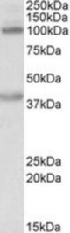 ZEB2 antibody (0.2 ug/ml) staining of Human Liver lysate (35 ug protein/ml in RIPA buffer). Primary incubation was 1 hour. Detected by chemiluminescence.