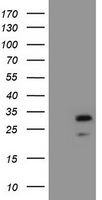 HEK293T cells were transfected with the pCMV6-ENTRY control (Left lane) or pCMV6-ENTRY ZFAND5 (Right lane) cDNA for 48 hrs and lysed. Equivalent amounts of cell lysates (5 ug per lane) were separated by SDS-PAGE and immunoblotted with anti-ZFAND5.