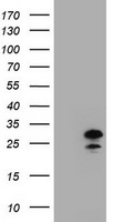 HEK293T cells were transfected with the pCMV6-ENTRY control (Left lane) or pCMV6-ENTRY ZFAND5 (Right lane) cDNA for 48 hrs and lysed. Equivalent amounts of cell lysates (5 ug per lane) were separated by SDS-PAGE and immunoblotted with anti-ZFAND5.