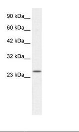 Jurkat Cell Lysate