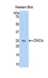 Western blot of recombinant ZFAND6.