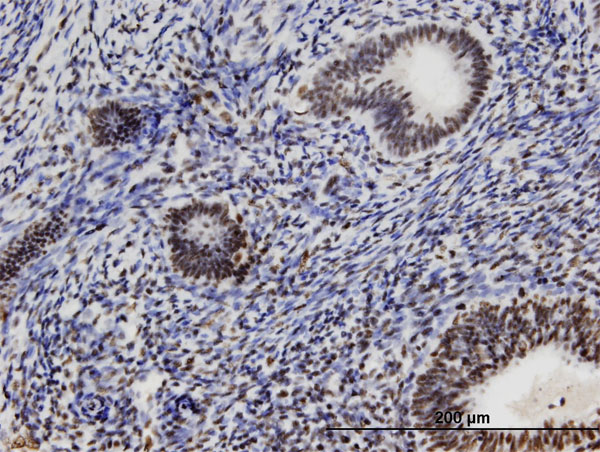 Immunoperoxidase of monoclonal antibody to ZFC3H1 on formalin-fixed paraffin-embedded human endometrium. [antibody concentration 3 ug/ml]