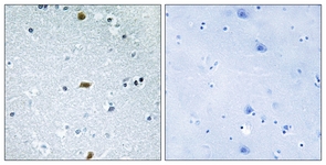 IHC of paraffin-embedded human brain tissue, using ZFHX3 Antibody. The picture on the right is treated with the synthesized peptide.
