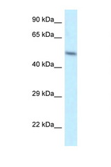ZFP2 antibody LS-C145541 Western blot of HeLa Cell lysate. Antibody concentration 1 ug/ml.