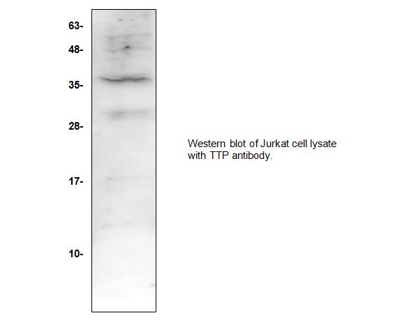 Western blot of ZFP36 / Tristetraprolin antibody LS-X234974.