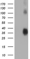 HEK293T cells were transfected with the pCMV6-ENTRY control (Left lane) or pCMV6-ENTRY ZFP36 (Right lane) cDNA for 48 hrs and lysed. Equivalent amounts of cell lysates (5 ug per lane) were separated by SDS-PAGE and immunoblotted with anti-ZFP36.