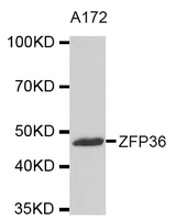 Western blot analysis of extracts of A172 cell line, using ZFP36 antibody.