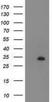 HEK293T cells were transfected with the pCMV6-ENTRY control (Left lane) or pCMV6-ENTRY ZFP36 (Right lane) cDNA for 48 hrs and lysed. Equivalent amounts of cell lysates (5 ug per lane) were separated by SDS-PAGE and immunoblotted with anti-ZFP36.