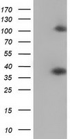 HEK293T cells were transfected with the pCMV6-ENTRY control (Left lane) or pCMV6-ENTRY ZFP36 (Right lane) cDNA for 48 hrs and lysed. Equivalent amounts of cell lysates (5 ug per lane) were separated by SDS-PAGE and immunoblotted with anti-ZFP36.