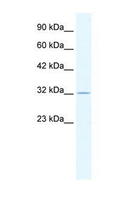 ZFP36 antibody LS-B1572 Western blot of HepG2 cell lysate.