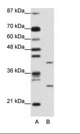 A: Marker, B: Jurkat Cell Lysate