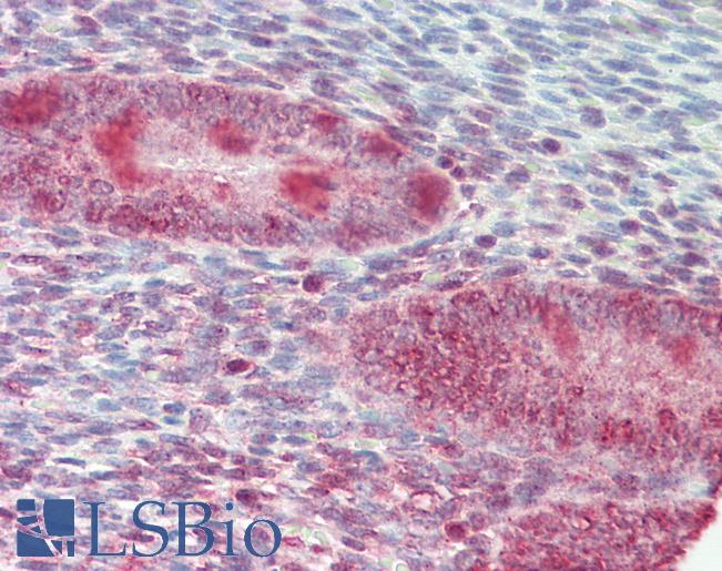 Anti-ZFP36L1 antibody IHC staining of human uterus. Immunohistochemistry of formalin-fixed, paraffin-embedded tissue after heat-induced antigen retrieval. Antibody LS-B10254 concentration 10 ug/ml.