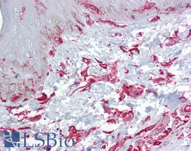 Anti-ZFP36L2 antibody IHC of human skin, dermal fibroblasts. Immunohistochemistry of formalin-fixed, paraffin-embedded tissue after heat-induced antigen retrieval. Antibody LS-B6682 concentration 5 ug/ml.