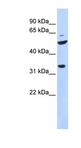 ZFP36L2 / TIS11D antibody LS-B6682 Western blot of 721_B cell lysate.