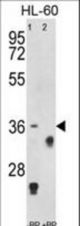 Western blot of anti-TNFRSF14 Antibody antibody pre-incubated without(lane 1) and with(lane 2) blocking peptide in HL-60 cell line lysate. TNFRSF14 (arrow) was detected using the purified antibody.