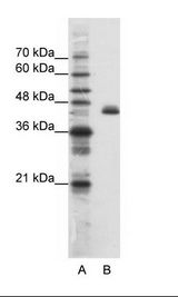A: Marker, B: HepG2 Cell Lysate