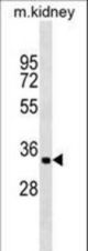 ZFP36L2 Antibody western blot of mouse kidney tissue lysates (35 ug/lane). The ZFP36L2 antibody detected the ZFP36L2 protein (arrow).