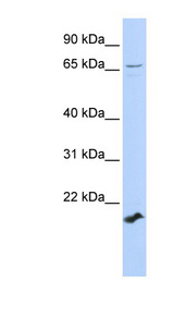 ZFP37 antibody LS-C101449 Western blot of 721_B cell lysate.