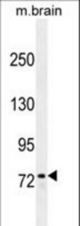 ZFP37 antibody western blot of mouse brain tissue lysates (35 ug/lane). The ZFP37 antibody detected the ZFP37 protein (arrow).
