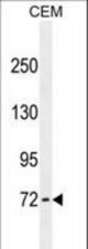 ZFP37 antibody western blot of CEM cell line lysates (35 ug/lane). The ZFP37 antibody detected the ZFP37 protein (arrow).