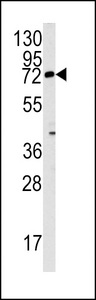 Western blot of Rex1 (ZFP42) antibody in mouse lung tissue lysates (35 ug/lane). Rex1 (arrow) was detected using the purified antibody.