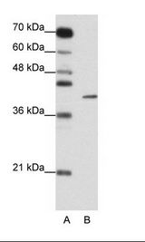 A: Marker, B: Jurkat Cell Lysate