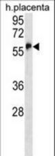 ZFP57 Antibody western blot of human placenta tissue lysates (35 ug/lane). The ZFP57 antibody detected the ZFP57 protein (arrow).