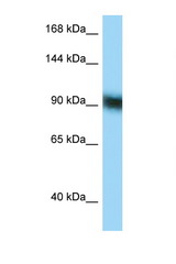 ZFP62 antibody LS-C146164 Western blot of 8226 Cell lysate. Antibody concentration 1 ug/ml.