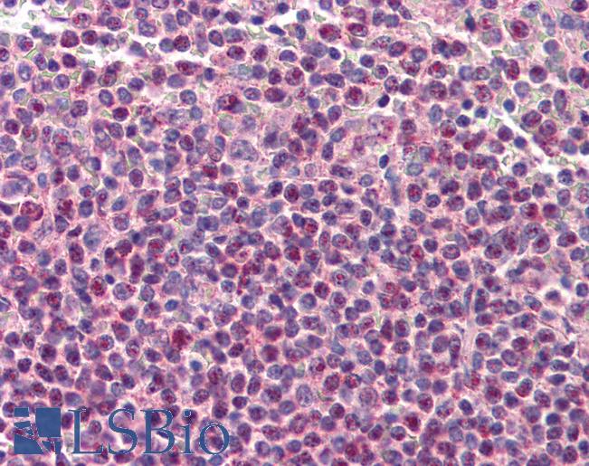 Anti-TNFRSF14 / CD270 antibody IHC of human spleen. Immunohistochemistry of formalin-fixed, paraffin-embedded tissue after heat-induced antigen retrieval. Antibody LS-B607 concentration 5 ug/ml.