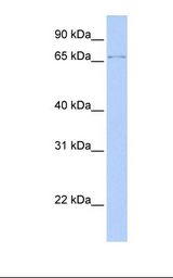Transfected 293T cell lysate. Antibody concentration: 1.0 ug/ml. Gel concentration: 12%.